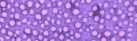 Exosomes released by fat cells may keep fat tissue healthy